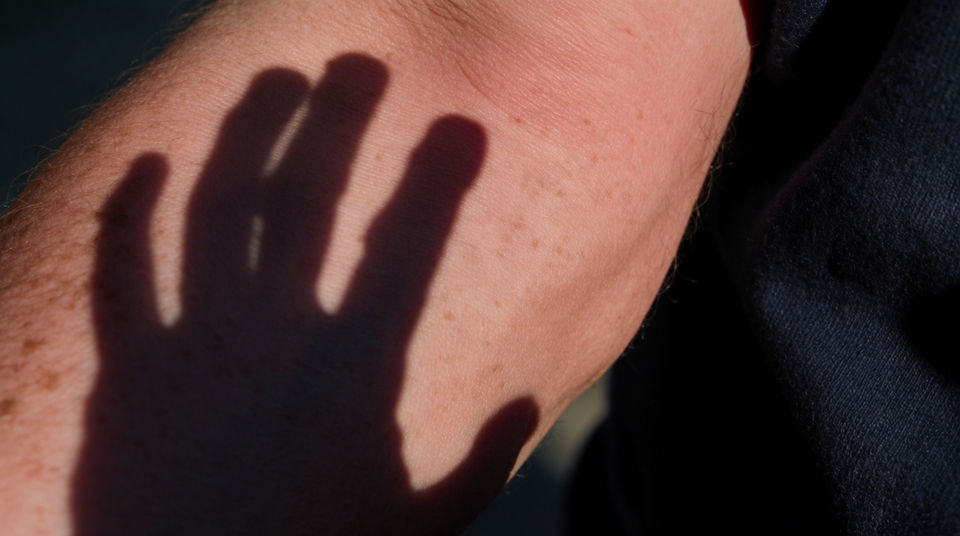 Put the sting exactly where the hand lands