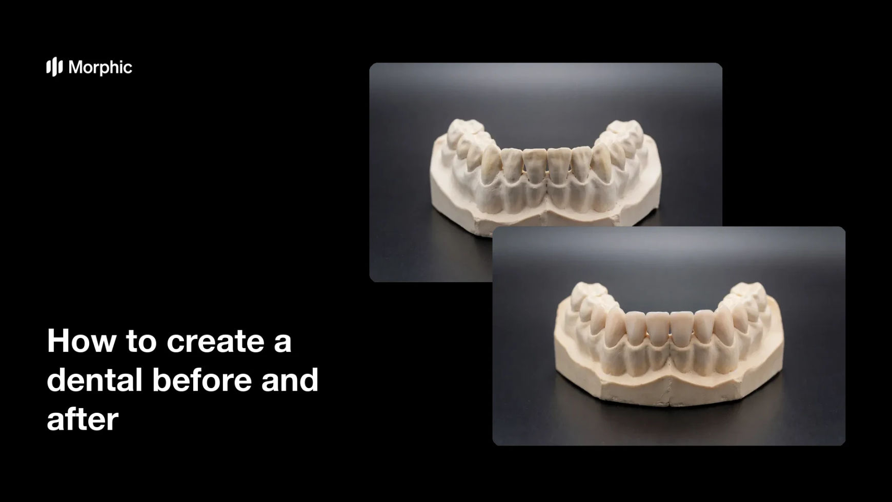 How to create a dental before and after