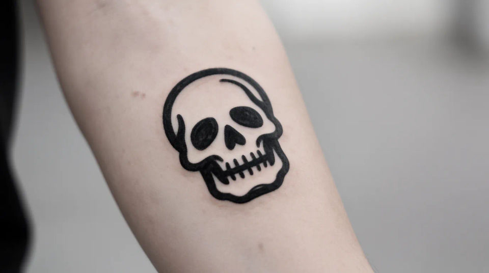 Forearm placement
