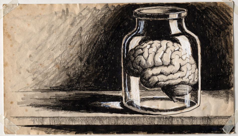 Brain in a specimen jar